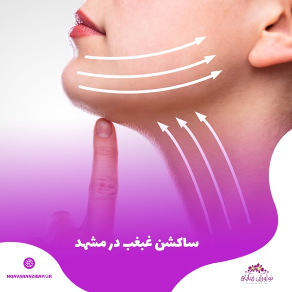  ساکشن غبغب در مشهد